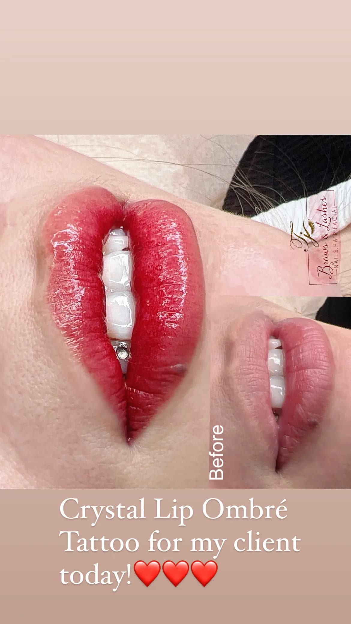 Crystal lip ombre treatment