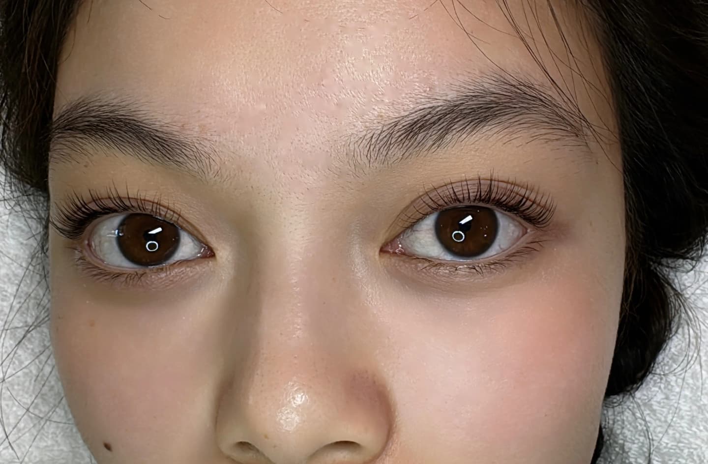 Complete eye area beautification