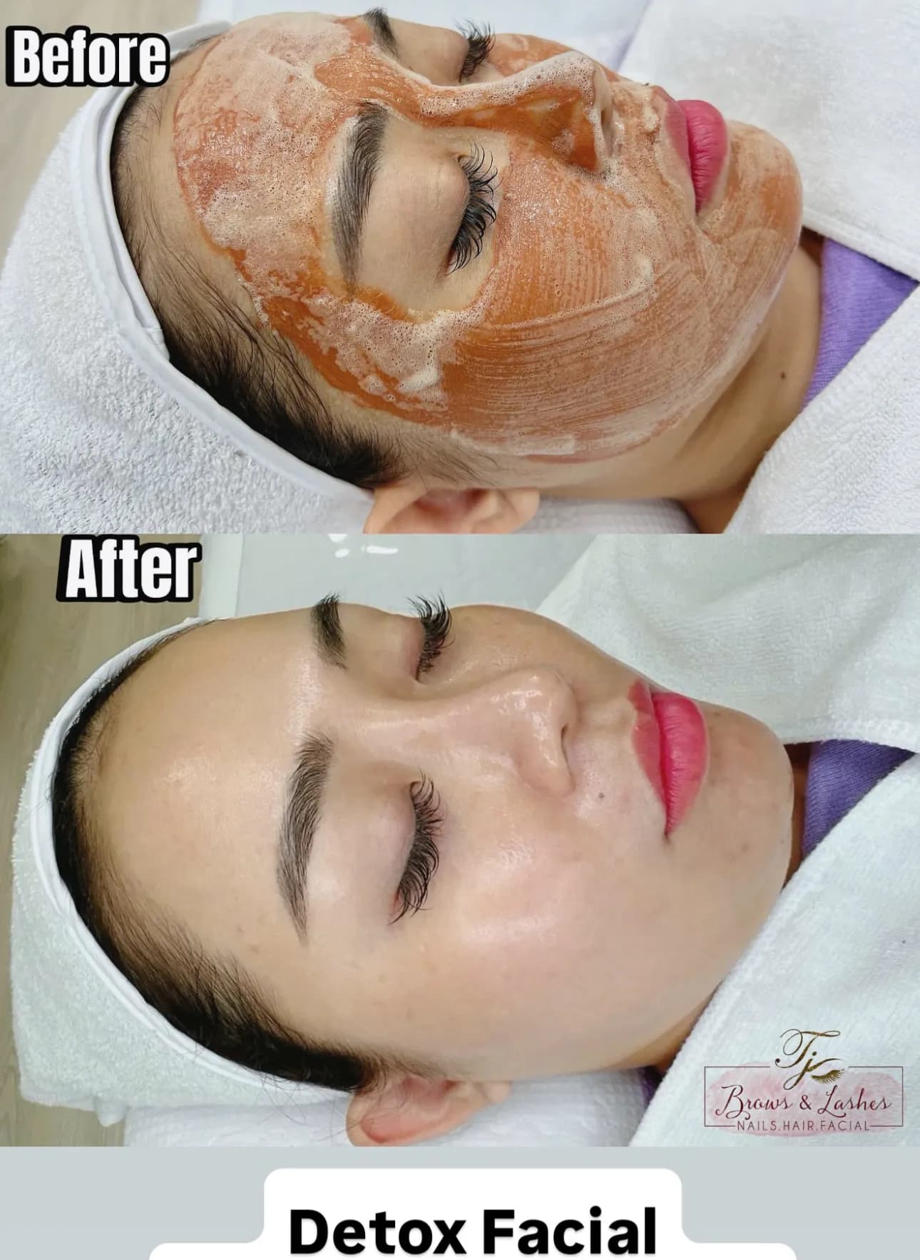 Facial treatment transformation results
