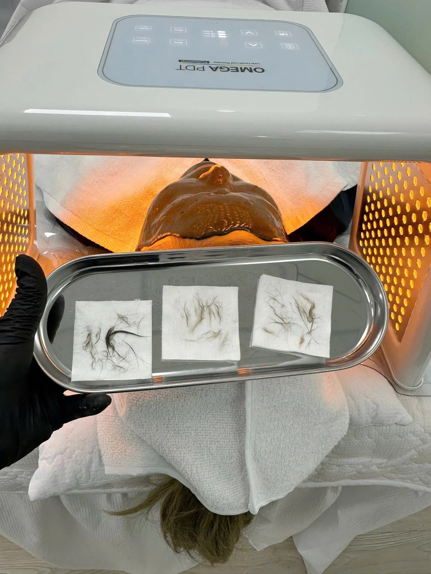 Advanced laser and UV lamp facial treatment